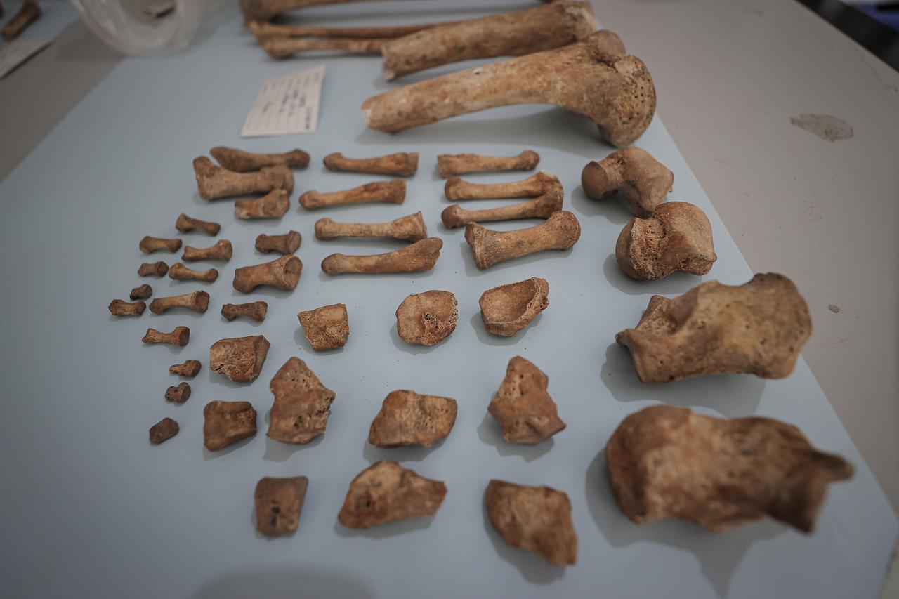 Bones under Roman theater in Iznik reveal Anatolia’s first plague  