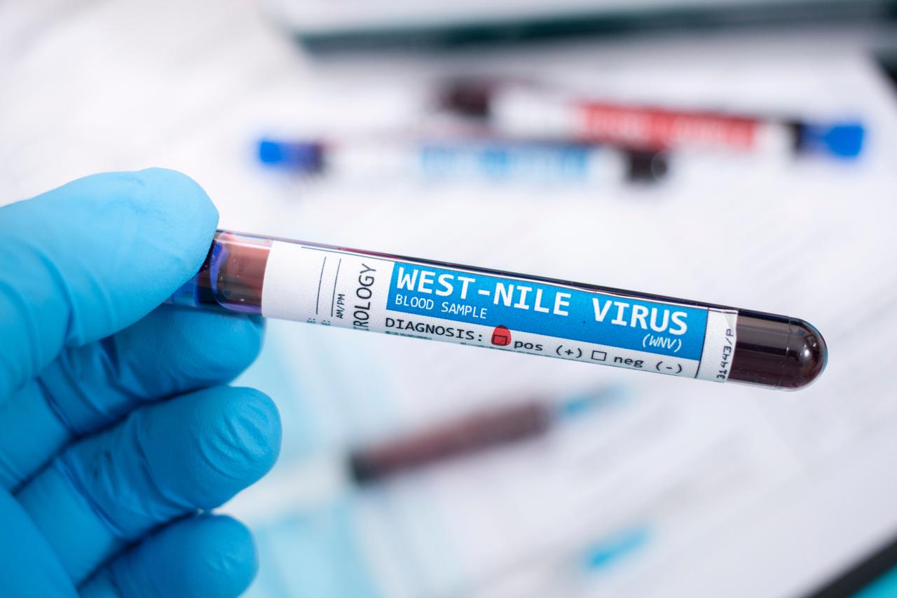 West Nile virus deaths rise across Europe