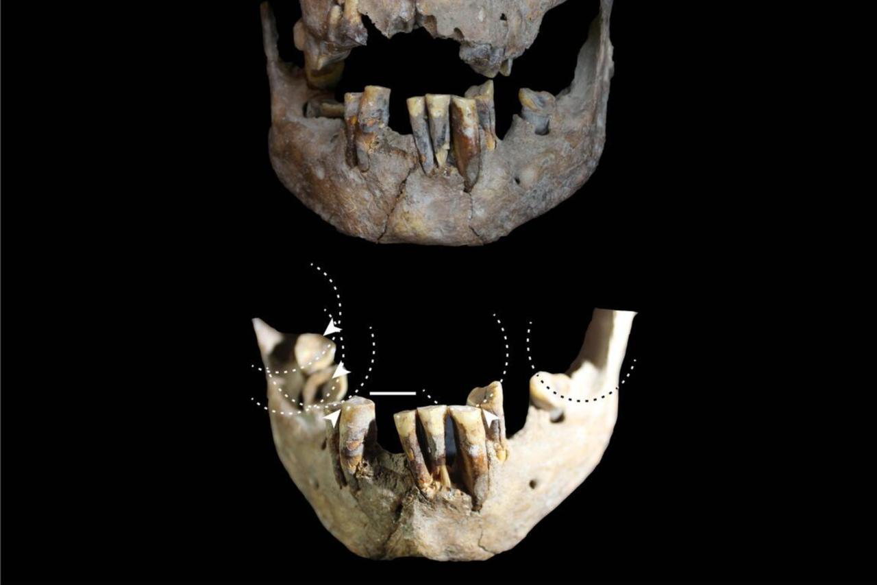 Study suggests humans used drugs 25,000 years ago