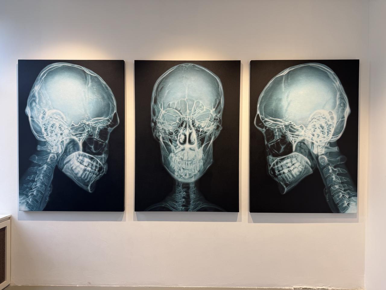 Three artworks depicting X-ray images of a human skull are displayed during Artweeks Istanbul's "Collectors" edition at Akaretler Siraevler in Besiktas, Istanbul, Türkiye, Sept. 16, 2026. (AA Photo)