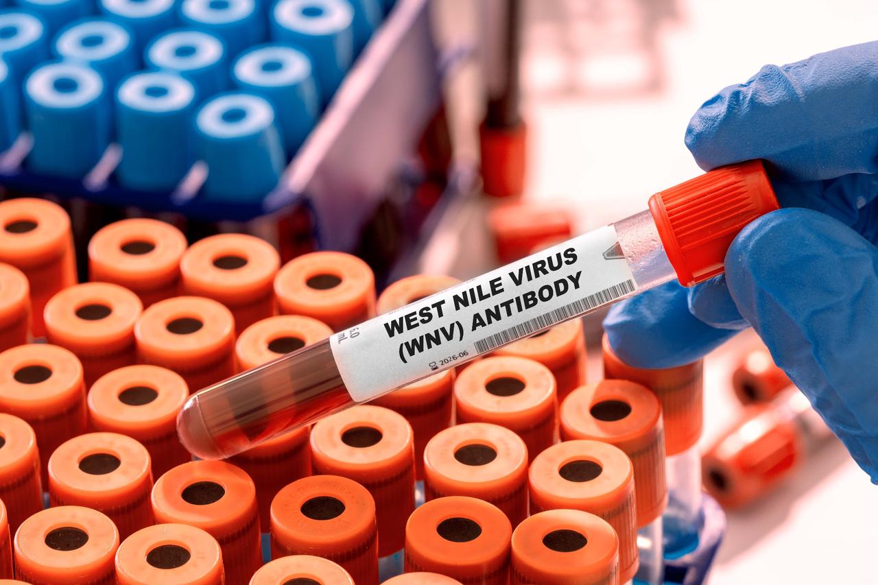Netherlands reports 9 new West Nile virus cases, 1 death