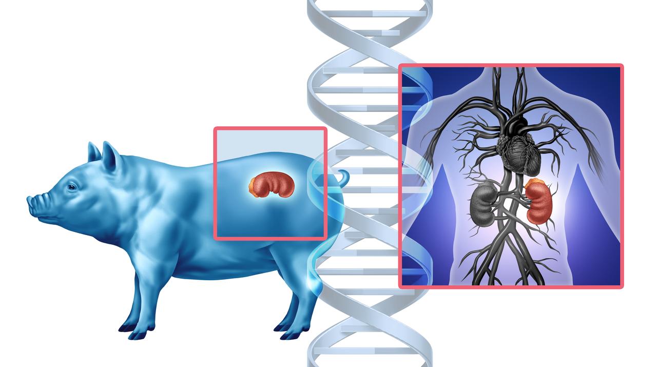 Illustration showing a pig kidney transplanted into a human body. (Photo via Adobe Stock)