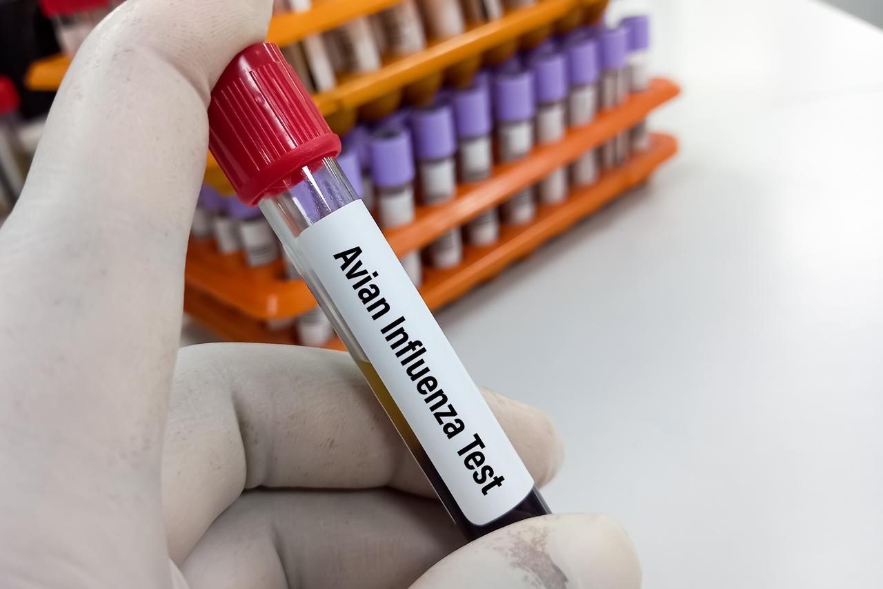 Uruguay declares nationwide health emergency over bird flu outbreak