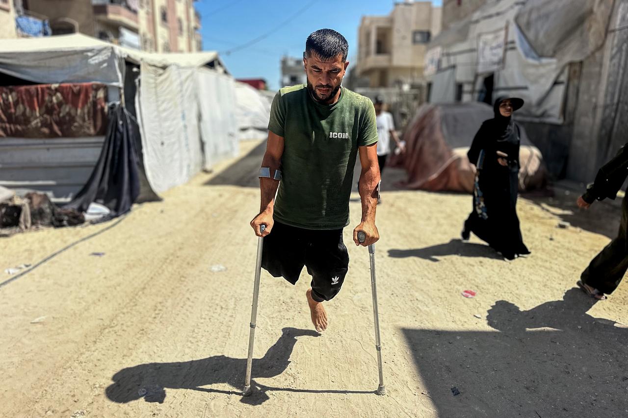 Palestinian Fadi Shakura, who lost one of his legs as a result of injuries sustained in Israeli attacks on the Gaza Strip, struggles to survive in a makeshift tent with his elderly parents and two children in Gaza City, Gaza, Palestine on September 02, 2026. (AA Photo)