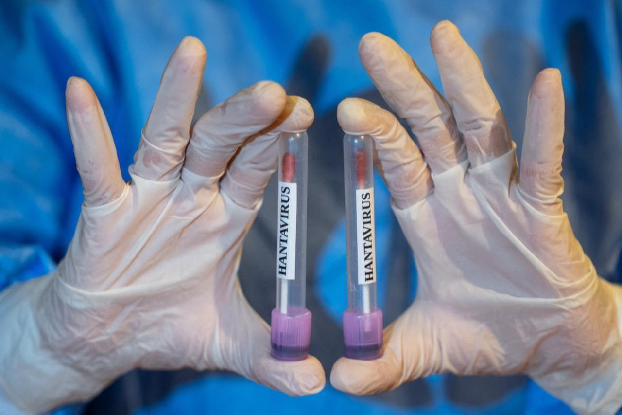 45 quarantined in France after teenager diagnosed with hantavirus