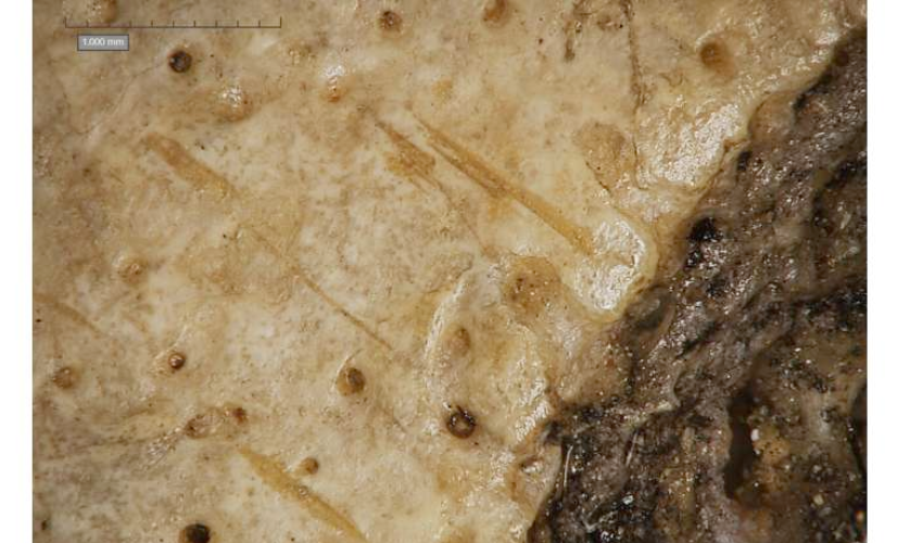Recent study shows ancient Egyptians' efforts to treat cancer 4,000 years ago